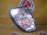 Габарит Toyota/Lexus 60-65 (81611-60210) R Land Cruiser Cygnus#LX470 UZJ100 Дефект креплений